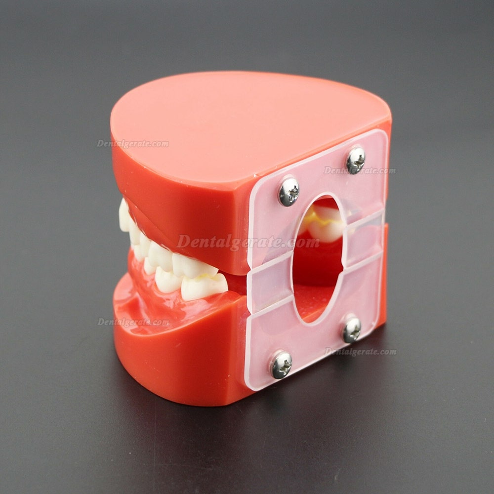 Dental Unterrichten Sie das Studium Erwachsene Standard Typodont Demonstrationsz&auml;hne Modell 7004 Rot